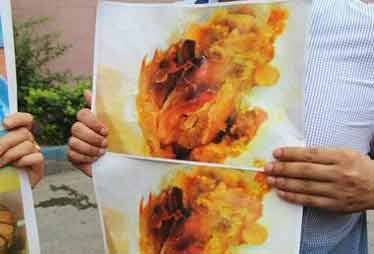 孕婦與侄女吃肯德基后雙雙中毒 公司暫無說法